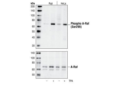 undefined Image 3: Raf Family Antibody Sampler Kit