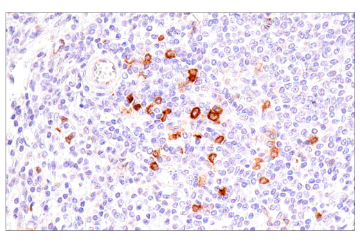Immunohistochemistry Image 2: IL3RA/CD123 (BR4MS) Mouse Monoclonal Antibody