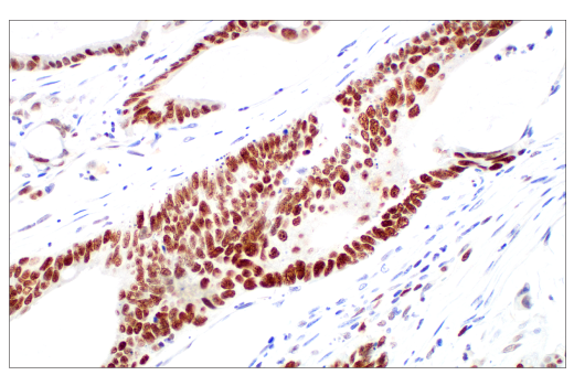 Immunohistochemistry Image 1: Ezh2 (D2C9) Rabbit Monoclonal Antibody (BSA and Azide Free)