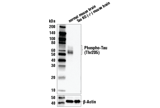 undefined Image 8: Pathological Hallmarks of Alzheimer's Disease Antibody Sampler Kit