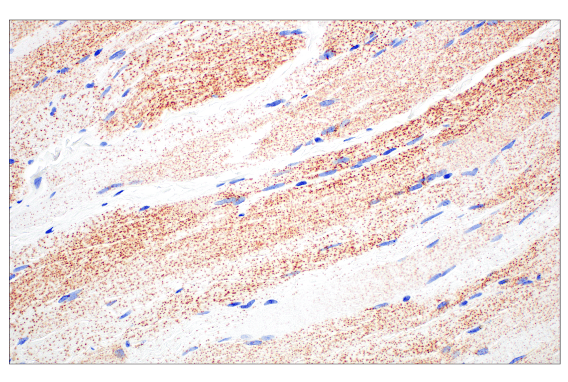 Immunohistochemistry Image 12: Perilipin-2 (E6G6M) Rabbit Monoclonal Antibody