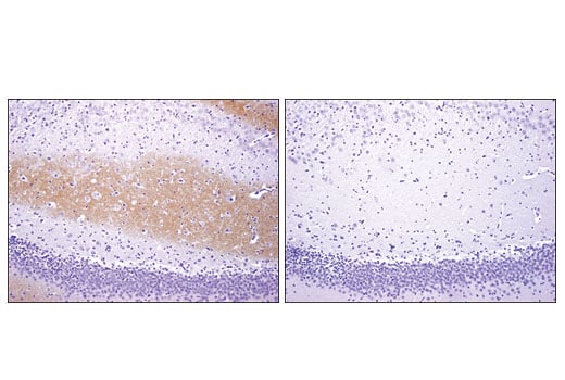 Immunohistochemistry Image 4: TrkC (C44H5) Rabbit Monoclonal Antibody