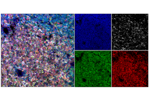 Confocal immunofluorescent analysis of fixed frozen mouse thymus, labeled with CD3 (17A2) Rat mAb (redFluor™ 710 Conjugate) #26582 (red), Iba1/AIF-1 (E4O4W) XP® Rabbit mAb (Alexa Fluor® 488 Conjugate) #20825 (gray pseudocolor), CD45 (D3F8Q) Rabbit mAb (Alexa Fluor® 555 Conjugate) #19581 (green pseudocolor), and DAPI #4083 (blue).