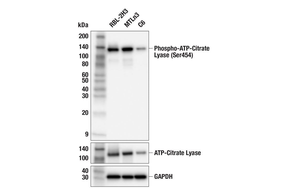 Western Blotting Image 5: Phospho-ATP-Citrate Lyase (Ser455) (F4T8R) Rabbit Monoclonal Antibody