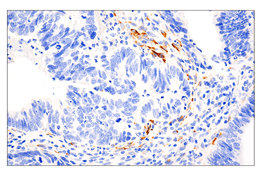 Immunohistochemistry Image 1: LOXL2 (E3P7Y) Rabbit Monoclonal Antibody (BSA and Azide Free)