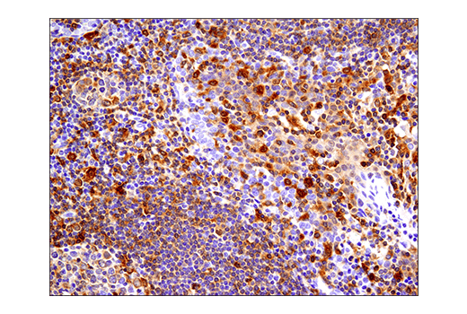Immunohistochemistry Image 3: IRF-5 (E7F9W) Rabbit Monoclonal Antibody (BSA and Azide Free)