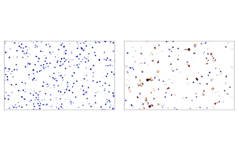 Immunohistochemistry Image 2: PD-L2 (D6L5A) Rabbit Monoclonal Antibody