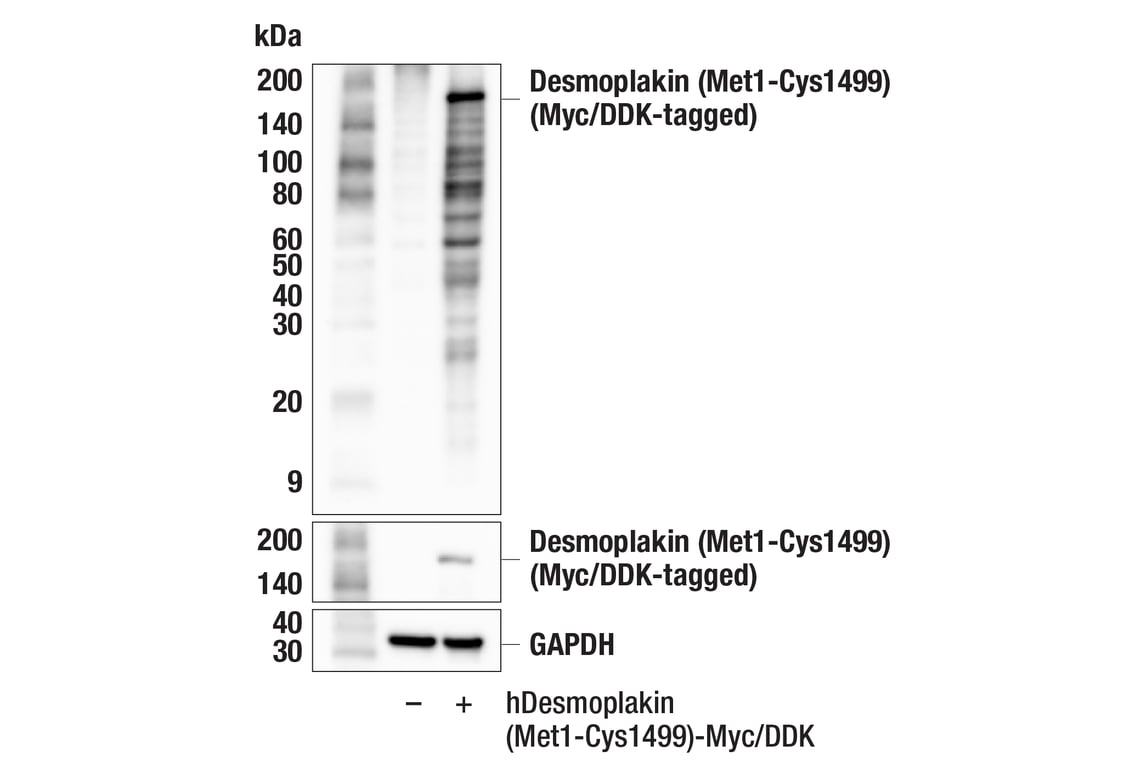 Western Blotting Image 2: Desmoplakin (F3J8Y) Rabbit Monoclonal Antibody