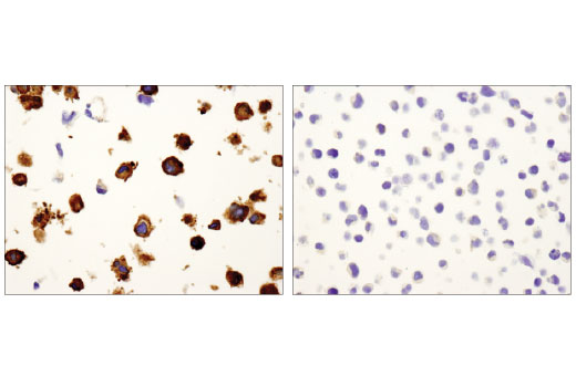 Immunohistochemistry Image 4: Vinculin (E1E9V) Rabbit Monoclonal Antibody