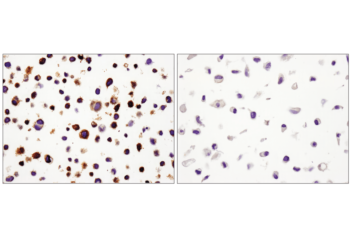 ピークハンド＋α カリブ① PD-L1 (E1L3N®) XP® Rabbit mAb | Cell Signaling Technology