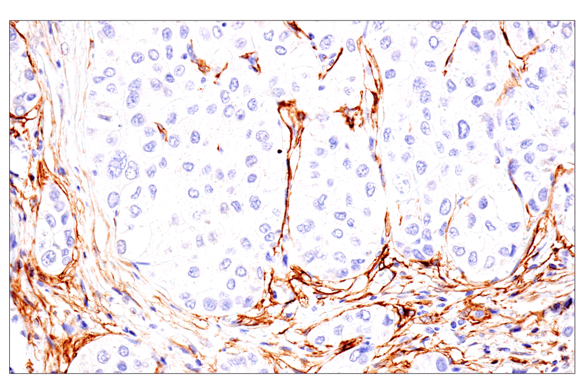 Immunohistochemistry Image 3: p75NTR (E7I3M) Rabbit Monoclonal Antibody (BSA and Azide Free)