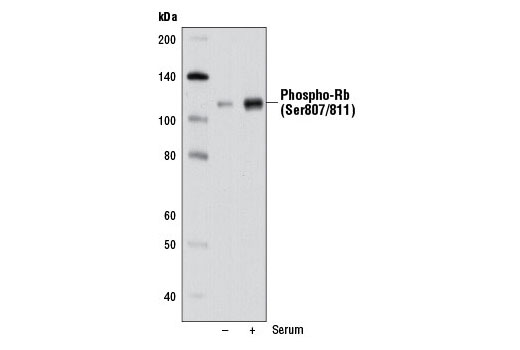 Western Blotting Image 2: Phospho-Rb (Ser807/811) (D20B12) Rabbit Monoclonal Antibody (BSA and Azide Free)