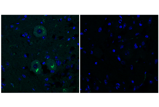 Immunofluorescence Image 2: TrueBlack<sup>®</sup> Lipofuscin Autofluorescence Quencher