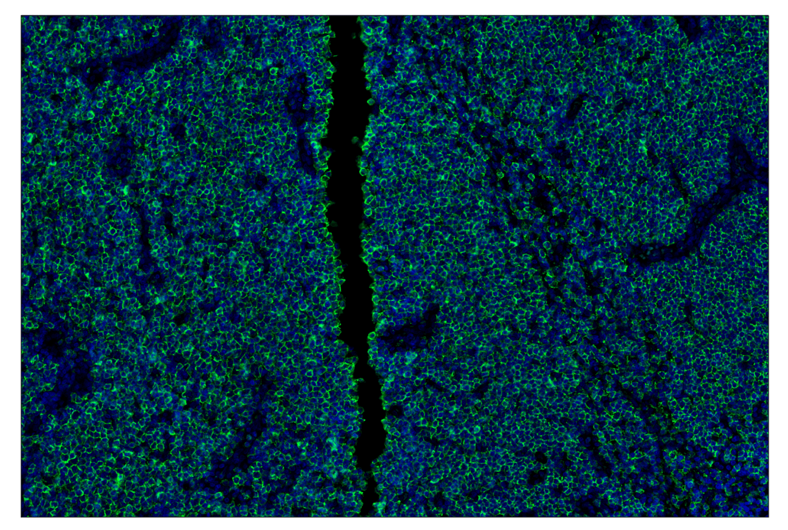 Immunohistochemistry Image 1: CD23 (E1R4G) & CO-0214-488 SignalStar<sup>®</sup> Oligo-Antibody Pair