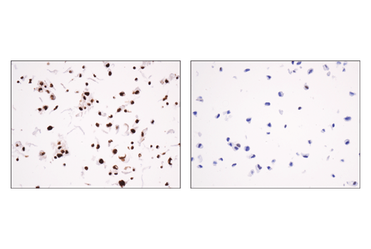 Immunohistochemistry Image 4: Asymmetric Dimethyl-SMARCC1/BAF155 (Arg1064) (D8I3U) Rabbit Monoclonal Antibody