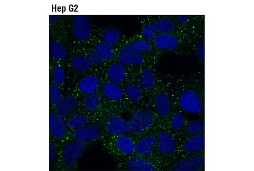 Immunofluorescence Image 1: DCP1B (D2P9W) Rabbit Monoclonal Antibody