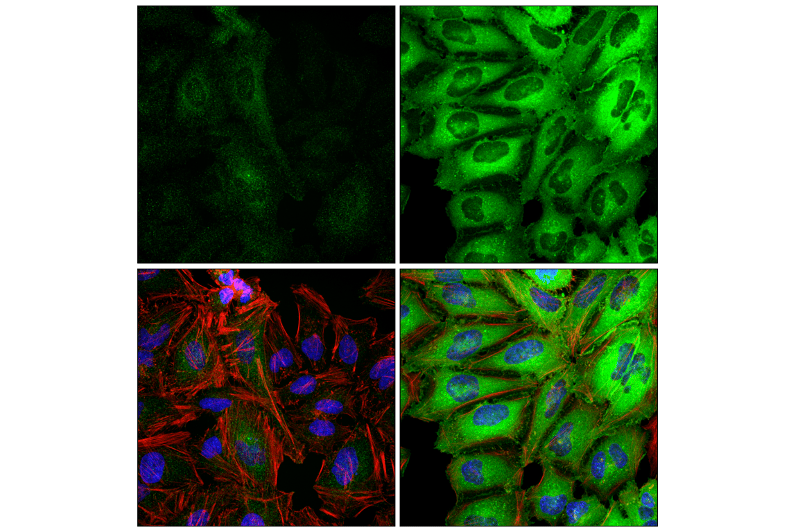 Immunofluorescence Image 1: GBP1 (F4Y1Y) Rabbit Monoclonal Antibody
