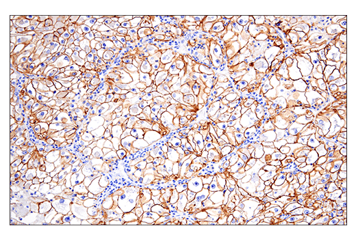 Immunohistochemistry Image 3: NCAM1 (CD56) (E7X9M) Rabbit Monoclonal Antibody (BSA and Azide Free)
