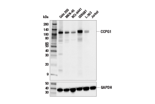 undefined Image 5: ER-phagy Cargo Receptor Antibody Sampler Kit