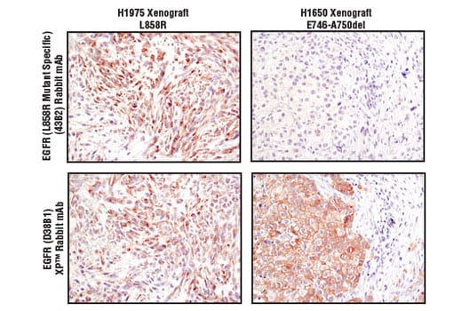 undefined Image 30: Lung Cancer RTK Antibody Sampler Kit