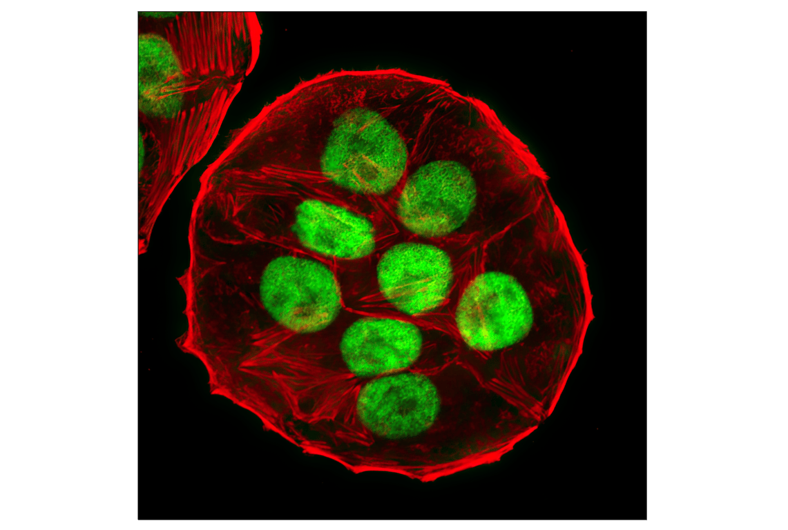 Immunofluorescence Image 1: p53 (7F5) Rabbit Monoclonal Antibody (BSA and Azide Free)