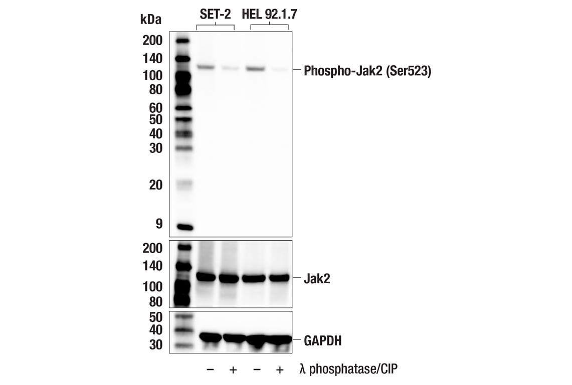 Western Blotting Image 2: Phospho-Jak2 (Ser523) (F8E8U) Rabbit Monoclonal Antibody