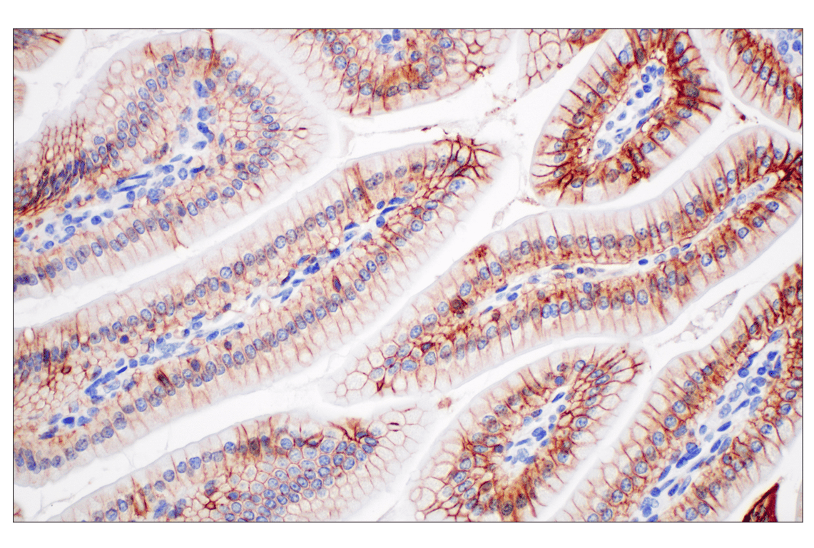Immunohistochemistry Image 7: EpCAM (D9S3P) Rabbit Monoclonal Antibody