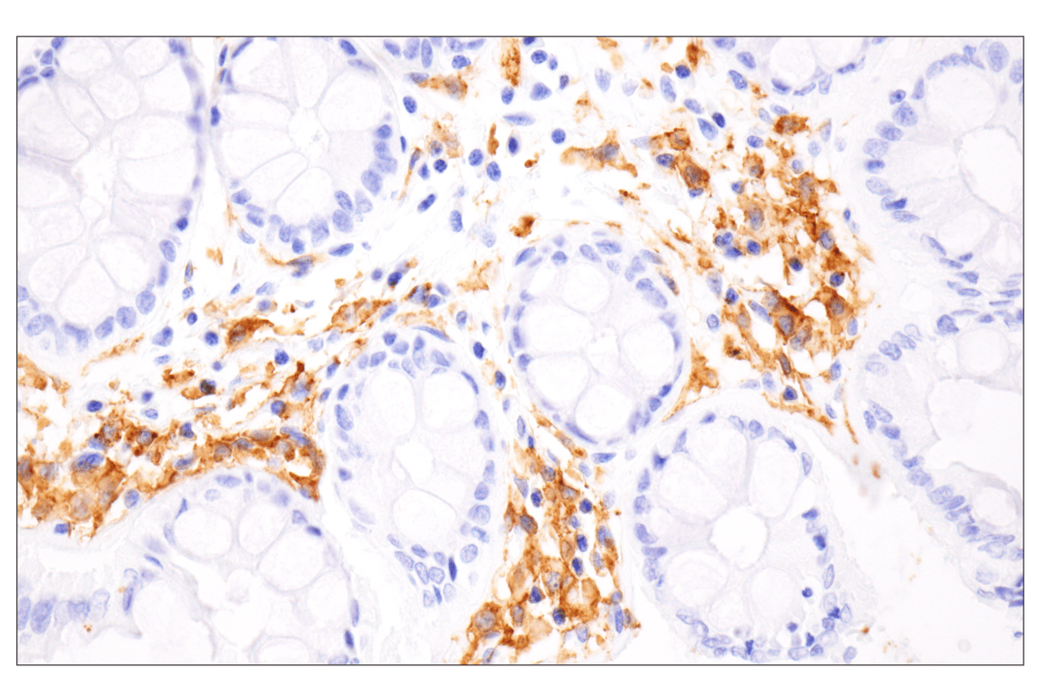 Immunohistochemistry Image 8: HLA-DRA (E9R2Q) Rabbit Monoclonal Antibody