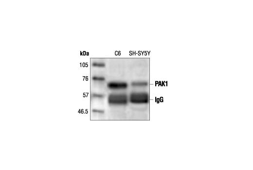 Immunoprecipitation Image 1: PAK1 Antibody