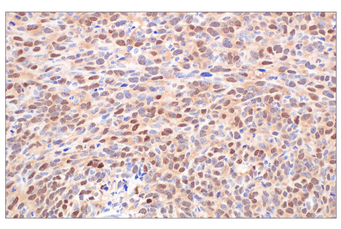 Immunohistochemistry Image 4: CDK4 (F8L5F) Rabbit Monoclonal Antibody