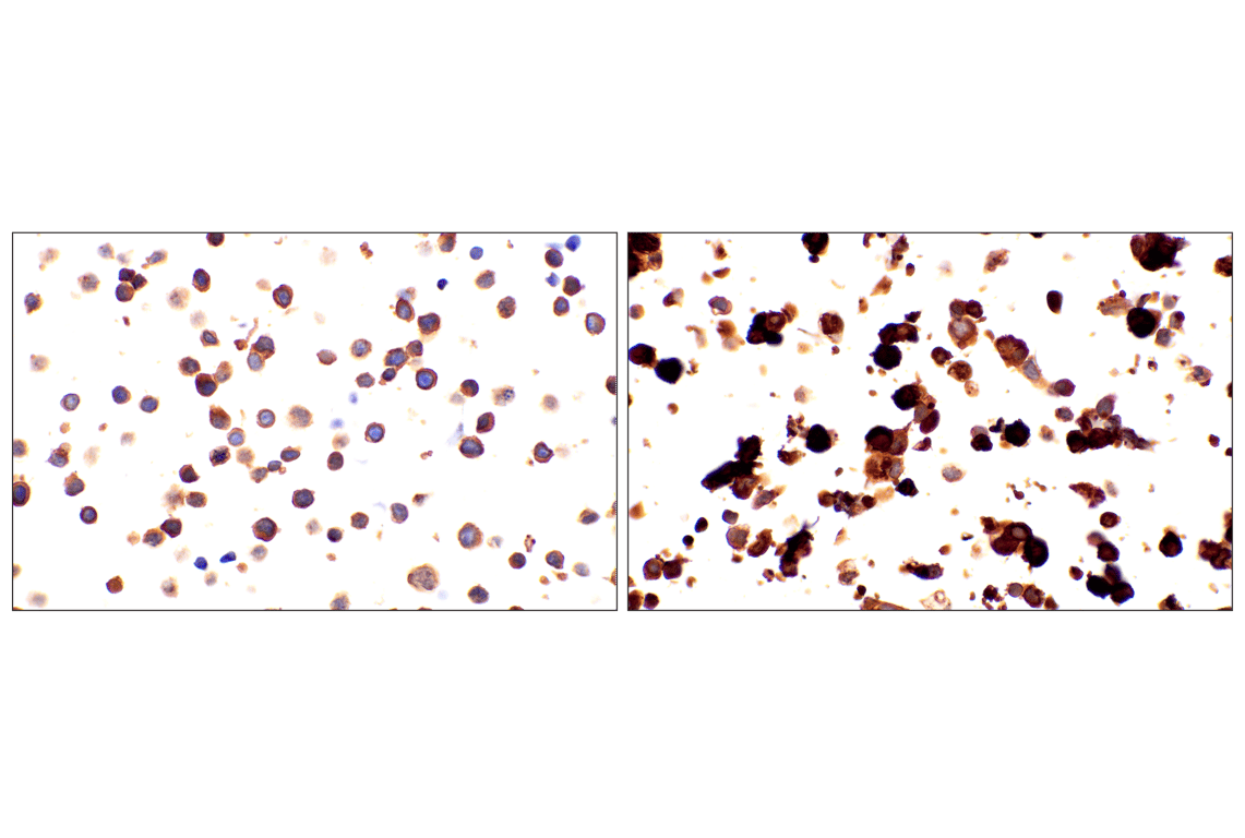 Immunohistochemistry Image 11: RhoA (67B9) Rabbit Monoclonal Antibody