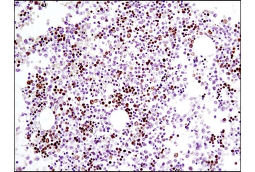 Immunohistochemistry Image 1: GATA-1 (D52H6) XP<sup>®</sup> Rabbit mAb (BSA and Azide Free)