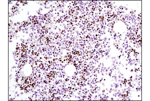 Immunohistochemistry Image 1: GATA-1 (D52H6) Rabbit Monoclonal Antibody (BSA and Azide Free)