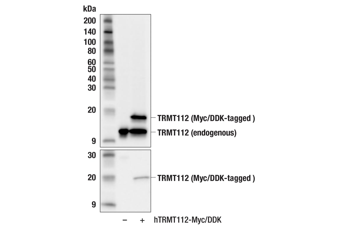 Western Blotting Image 2: TRMT112 (F1A6F) Rabbit Monoclonal Antibody