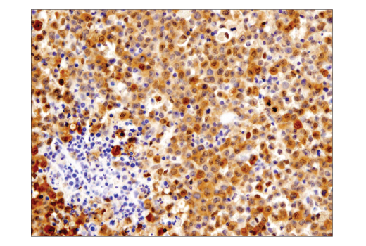Immunohistochemistry Image 2: Stat1 (D1K9Y) Rabbit Monoclonal Antibody (BSA and Azide Free)
