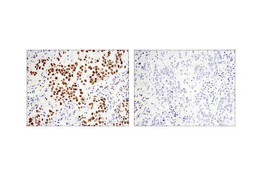 Immunohistochemistry Image 4: Phospho-ATF-2 (Thr71)/ATF-7 (Thr53) (E4A5G) Rabbit Monoclonal Antibody