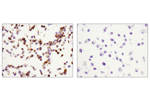 Immunohistochemistry Image 1: IGFBP1 (D4E9T) Rabbit Monoclonal Antibody (BSA and Azide Free)