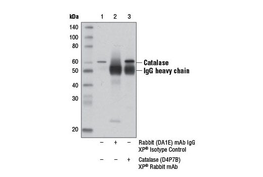 Immunoprecipitation Image 1: Catalase (D4P7B) Rabbit Monoclonal Antibody