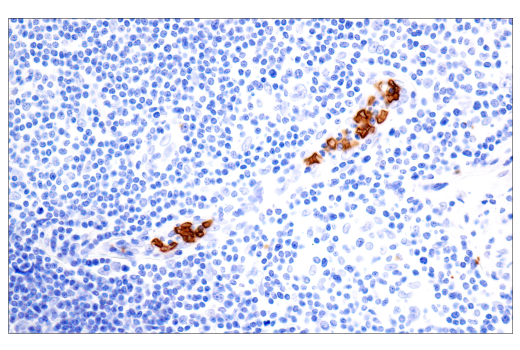 Immunohistochemistry Image 3: CD235a/Glycophorin A (JC159) Rabbit Monoclonal Antibody