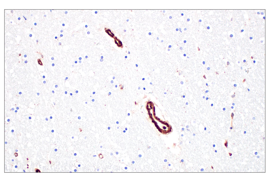 Immunohistochemistry Image 10: Filamin A (E8P8M) Rabbit Monoclonal Antibody