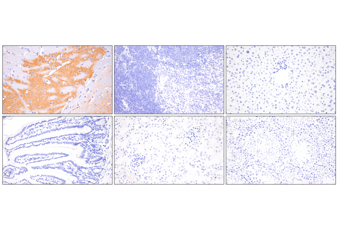 Immunohistochemistry Image 2: SynGAP-alpha2 (E4Y6I) Rabbit Monoclonal Antibody