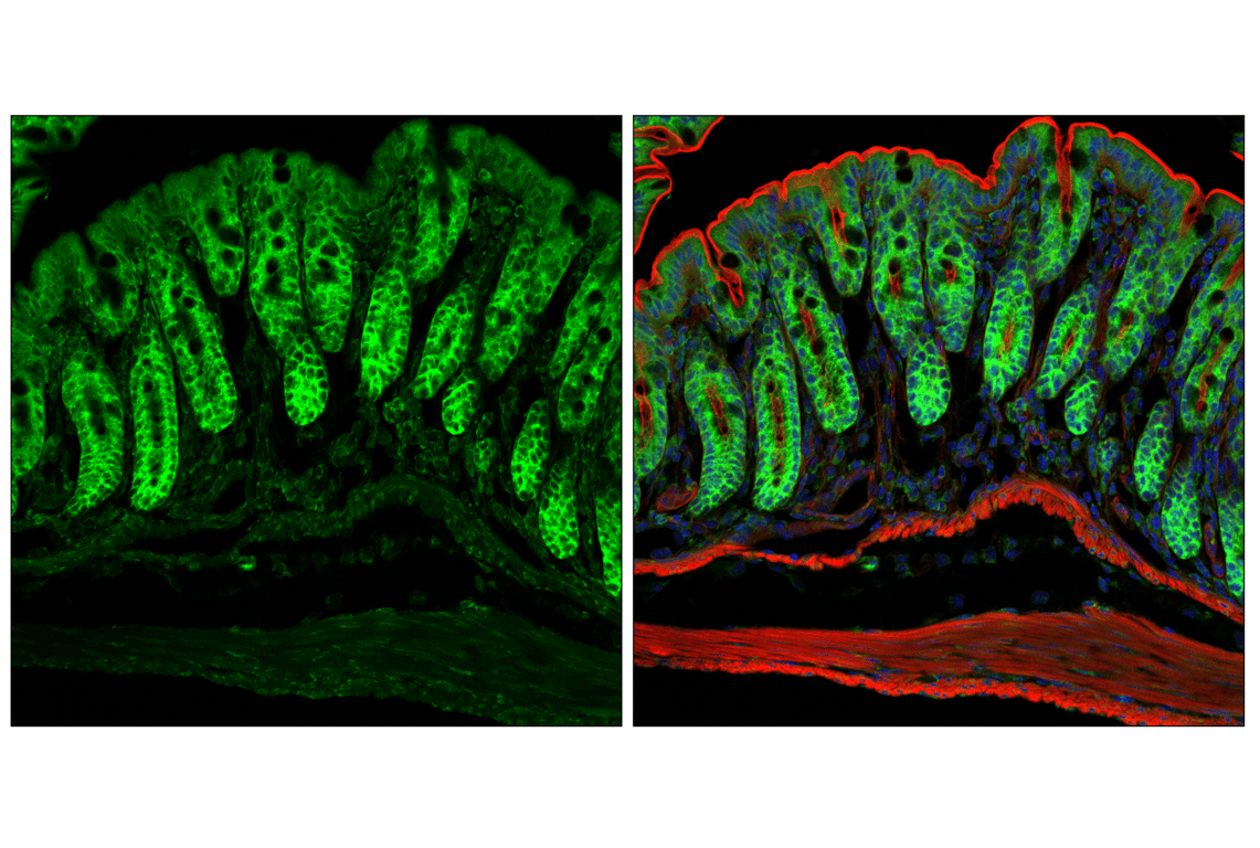 Immunofluorescence Image 1: YTHDF3 (E2J9I) Rabbit Monoclonal Antibody