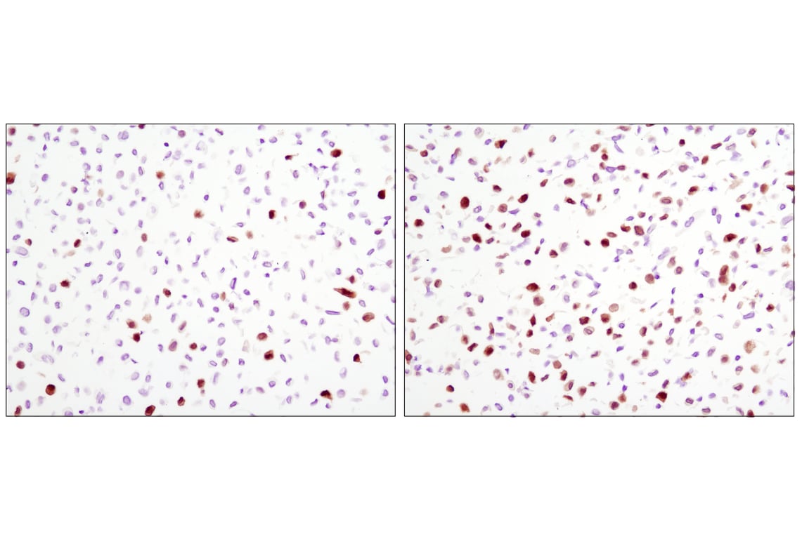 Phospho-Erk1/2 Pathway Antibody Sampler Kit | Cell Signaling