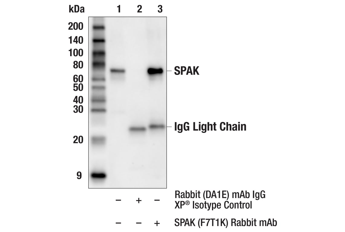 Immunoprecipitation Image 1: SPAK (F7T1K) Rabbit Monoclonal Antibody