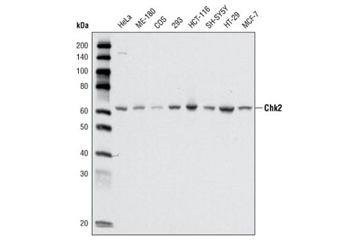 Western Blotting Image 2: Chk2 (1C12) Mouse Monoclonal Antibody (BSA and Azide Free)