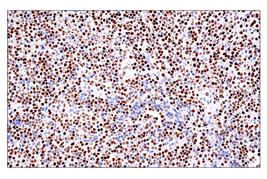 Immunohistochemistry Image 2: PML (E6S9L) Rabbit Monoclonal Antibody