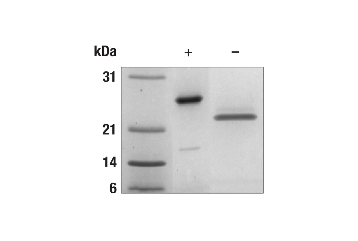 undefined Image 1: Human OSM Recombinant Protein