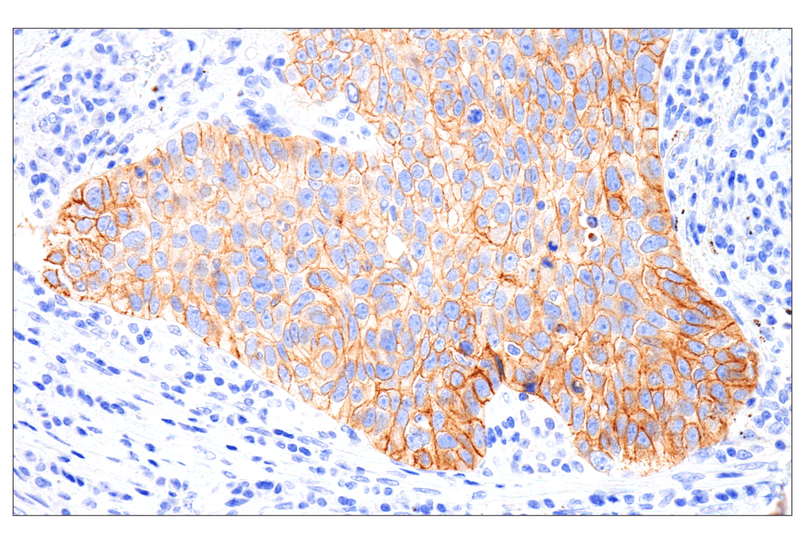 Immunohistochemistry Image 1: IGF-I Receptor beta (D4O6W) Rabbit Monoclonal Antibody