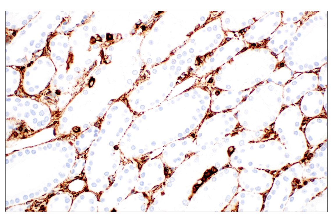 Immunohistochemistry Image 4: Vimentin (D21H3) Rabbit Monoclonal Antibody (BSA and Azide Free)