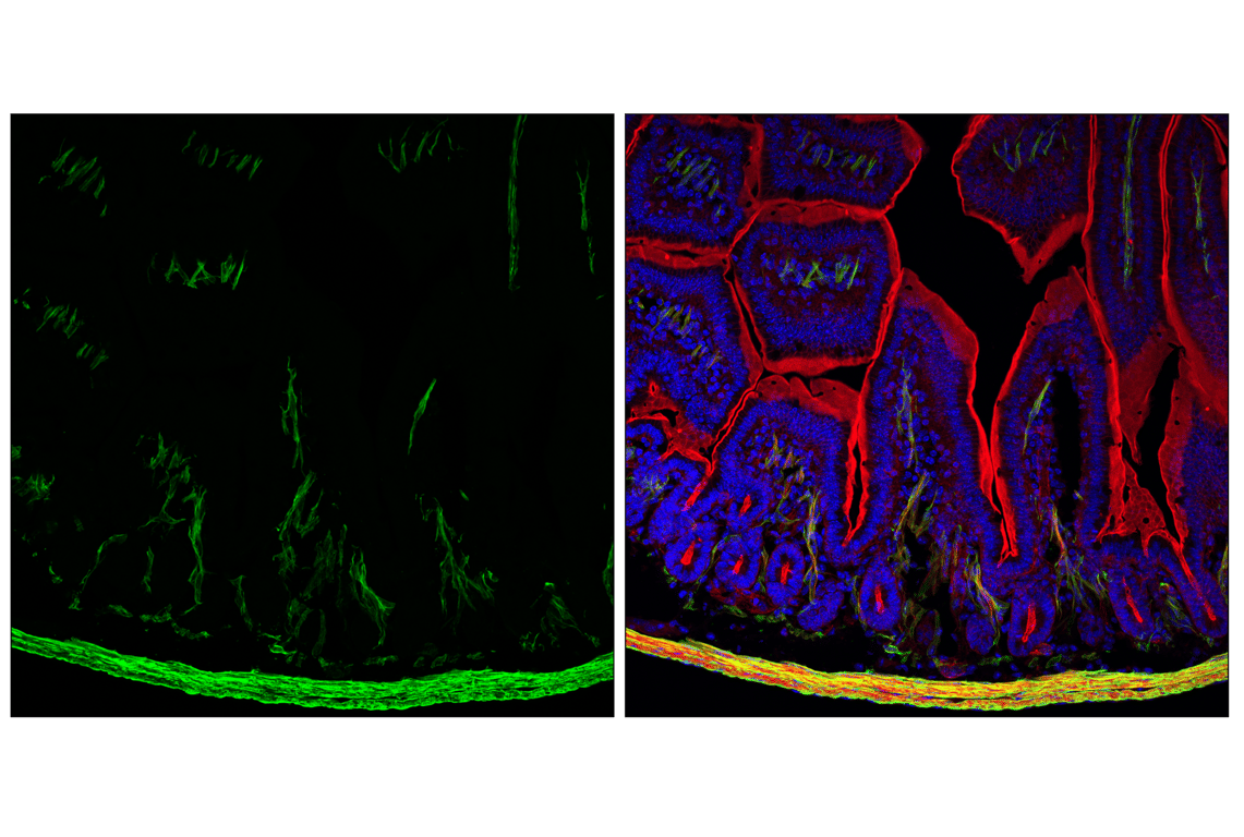 Immunofluorescence Image 2: MYH11 (E4Q4L) Rabbit Monoclonal Antibody